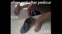 Before and after pedicure Thumb
