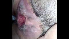Coroa Thumb