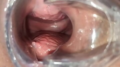 Masturbation with womb view and medical speculum, close up of my pussy Thumb